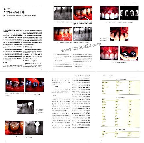 【国际牙科名着系列-口腔种植学临床操作指南】下载
