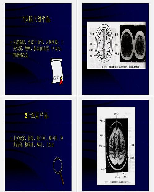 【颅脑CT-MRI】下载